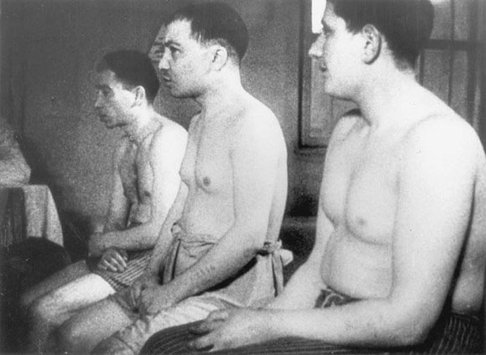 Picture 3 of The most gruesome human experiments in history