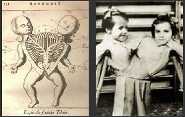 Picture 4 of The most gruesome human experiments in history