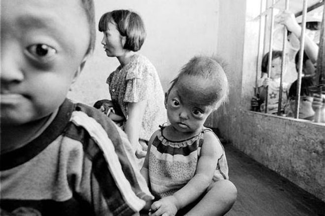 Picture 5 of The most gruesome human experiments in history