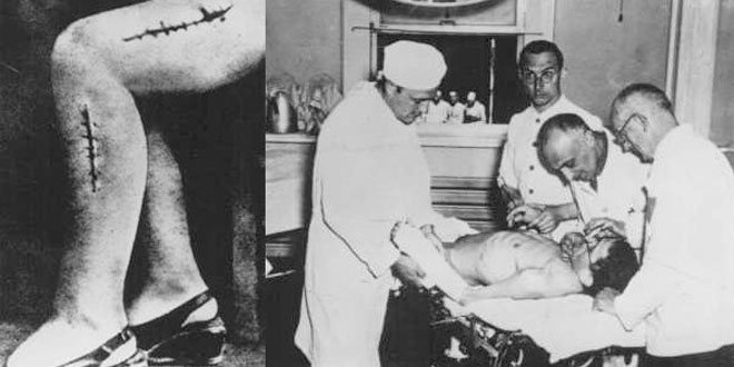 Picture 6 of The most gruesome human experiments in history