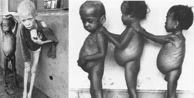 Picture 5 of The most heartbreaking photos in the world