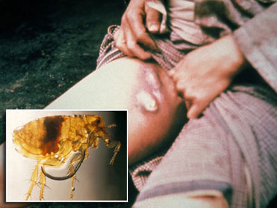 Picture 1 of The most terrible diseases of all time
