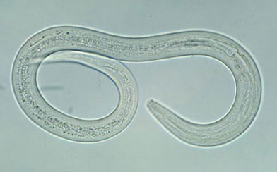 Picture 6 of The most terrible diseases of all time