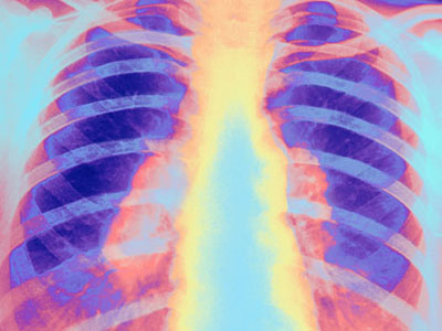 Picture 7 of The most terrible diseases of all time