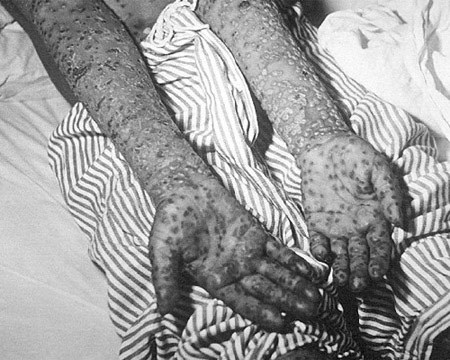 Picture 8 of The most unique healing technique in the human world