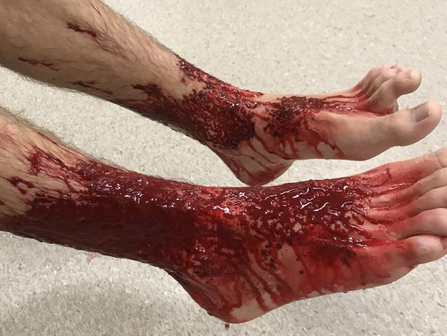 Picture 1 of The mysterious carnivorous marine life is causing many people to fear