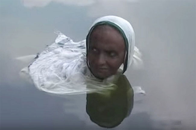 Picture 1 of The mysterious disease caused the woman to become a