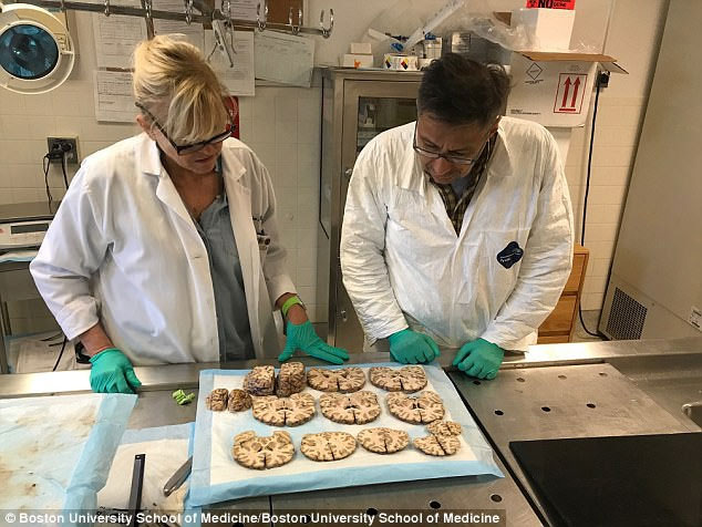 The mysterious disease is only diagnosed after the patient has died, because the doctor needs to cut their brain images 6