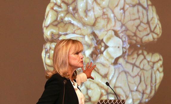 The mysterious disease is only diagnosed after the patient has died, because the doctor needs to cut their brain images 8