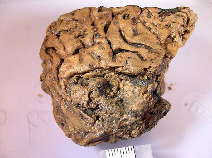 Picture 1 of The mystery of the ancient human brain remained intact for 2,600 years without decay