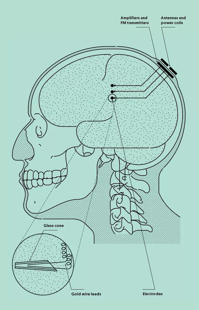 Picture 3 of The neurologist hacked his brain and almost lost his memory