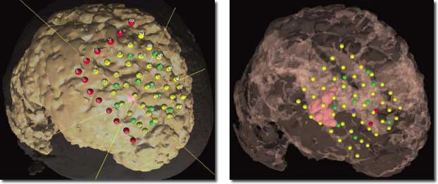 Picture 7 of The neurologist hacked his brain and almost lost his memory