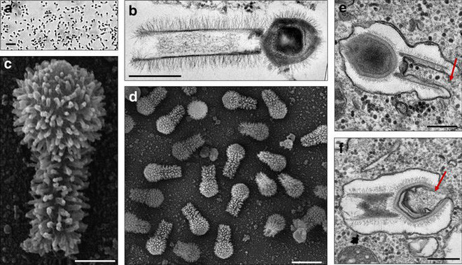 Picture 2 of The newly discovered giant virus can change our definition of viruses