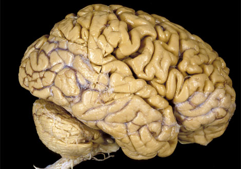 Picture 1 of The odd misconceptions in science