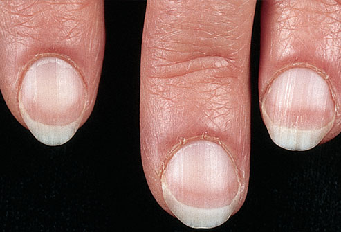 Picture 2 of The odd odd under the nail