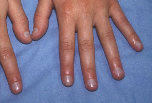Picture 5 of The odd odd under the nail