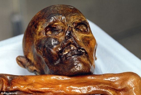 Picture 1 of The oldest blood cell on the Otzi ice mummy
