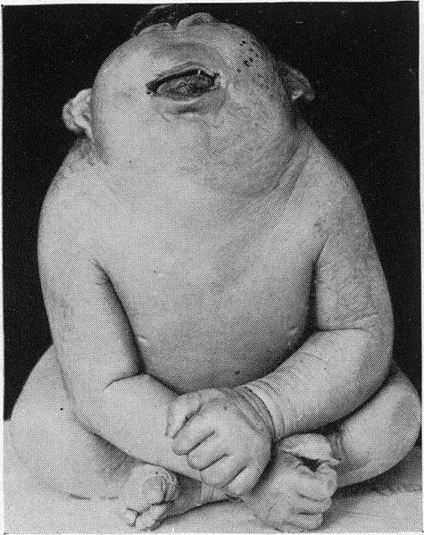 Picture 4 of The 'one-eyed giant' - the mythical figure turned out to be real