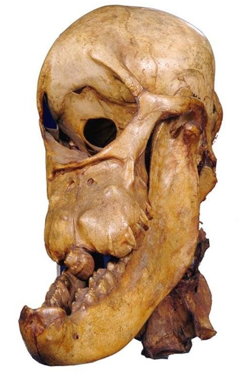 Picture 7 of The 'one-eyed giant' - the mythical figure turned out to be real