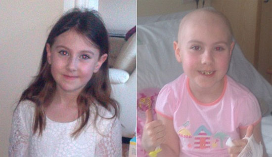 Picture 1 of The only girl in the world who has 2 leukemia
