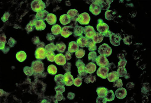 Picture 2 of The parasite is in danger of extinction due to climate change
