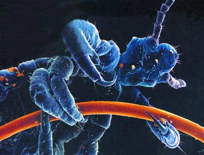 Picture 6 of The parasitic world