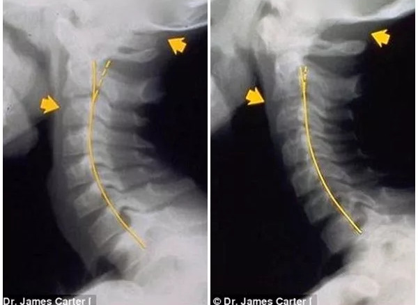 Picture 4 of The photo shows scary reality from smartphone addiction