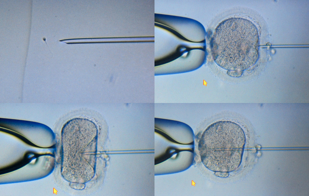 Picture 9 of The process of creating babies in test tubes