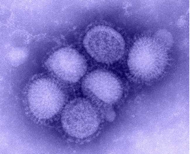Picture 1 of The process of forming the H1N1 virus