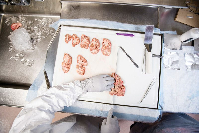Picture 2 of The process of turning human brain into immortality in America