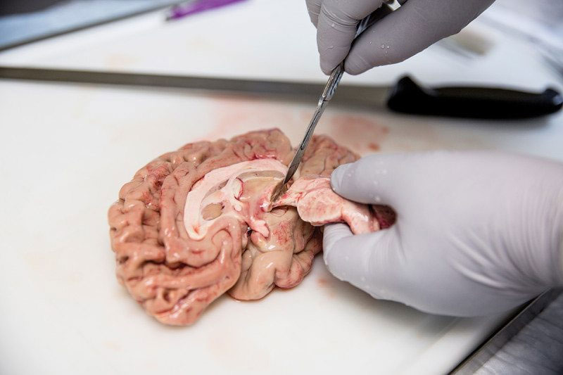 Picture 3 of The process of turning human brain into immortality in America