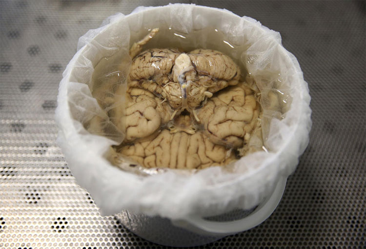 Picture 6 of The process of turning human brain into immortality in America