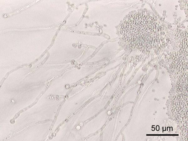 Picture 1 of The process of yeast reproduction does not have mating genes