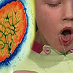 Picture 1 of The prospect of pertussis vaccine
