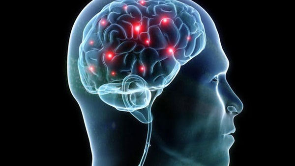 Picture 2 of The psychological cause of the