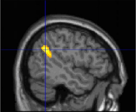 Picture 1 of The reason we remember dreams after waking up