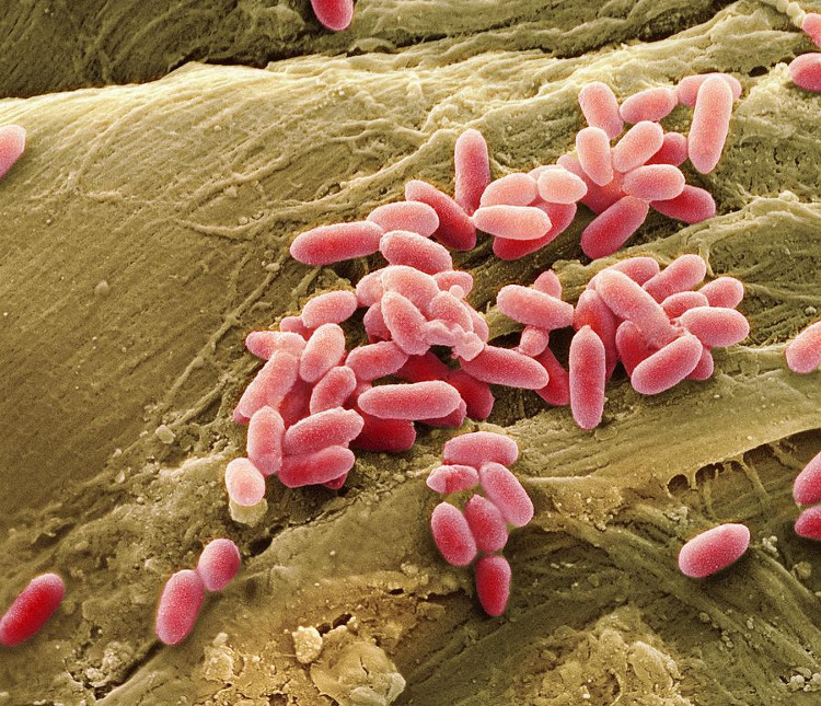 Picture 1 of The reason why some people suffer from wounds for a long time heals