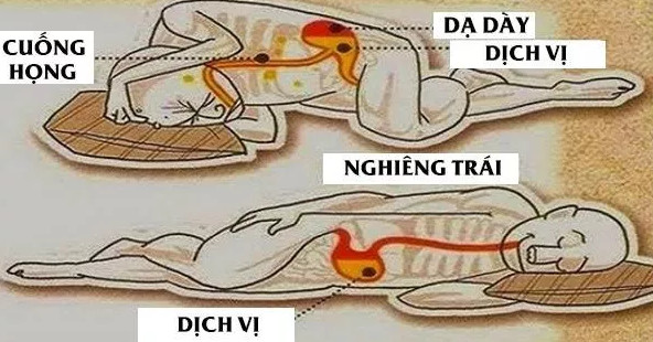 Picture 3 of The reason why you should just sleep on your left side