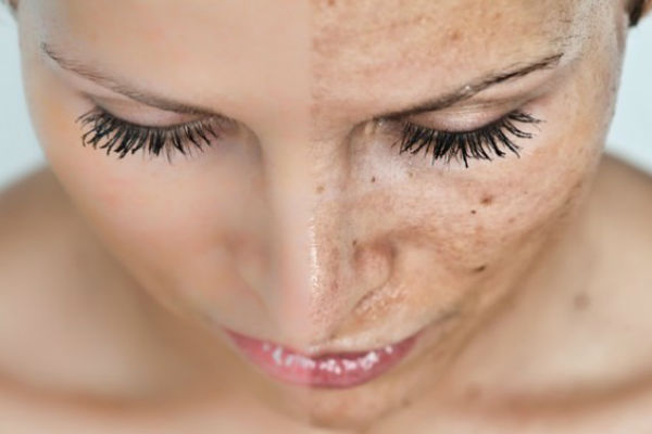 Picture 3 of The reason you should drink warm water instead of cold water