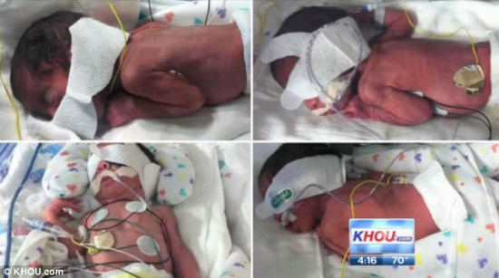 Picture 1 of The record lays 2 twins at the same time