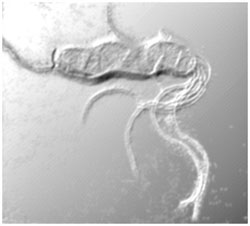 Picture 1 of The resentment of bacteria causes stomach diseases