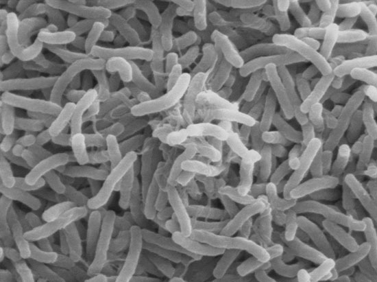 Picture 1 of The risk of food poisoning increases because the ocean is warmer