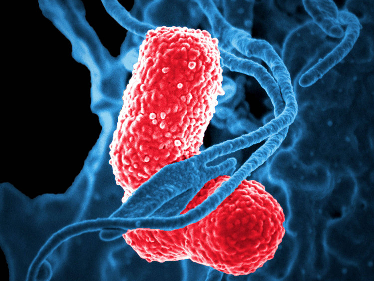 Picture 1 of The scary truth about antibiotic-resistant bacteria