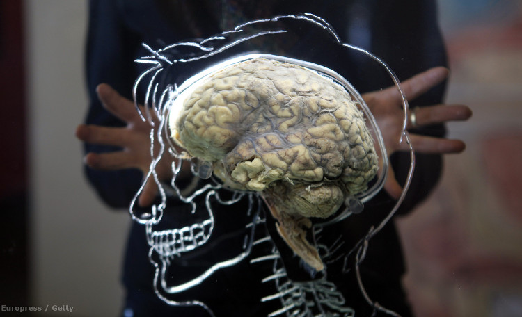 Picture 2 of The scientist claims to help the brain dead again