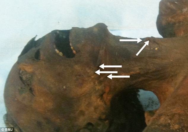 Picture 2 of The secret behind the death of the last Pharaoh