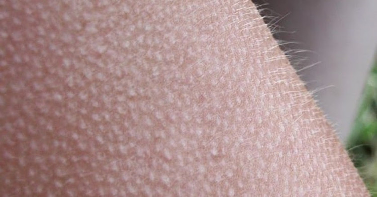 Picture 3 of The secret of a single part of the body never