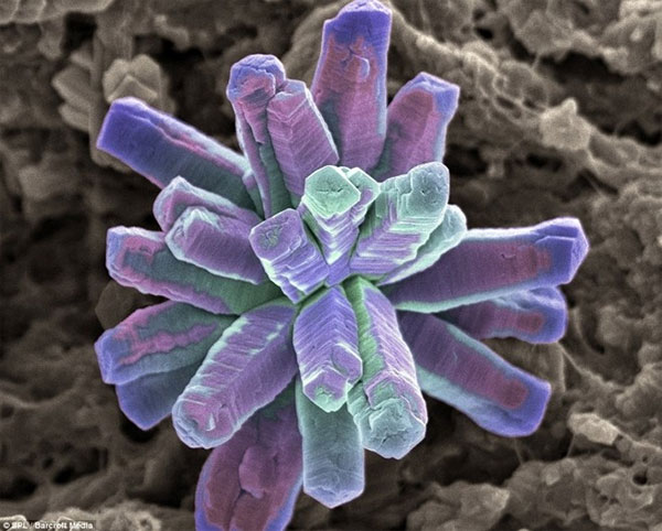 Picture 10 of The shape of bacteria attaches to human teeth