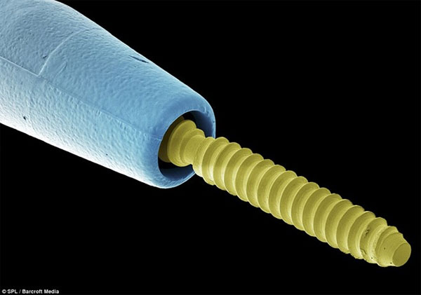 Picture 11 of The shape of bacteria attaches to human teeth