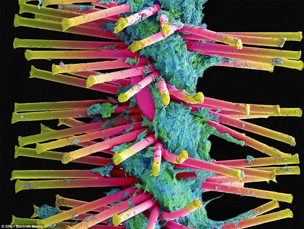 Picture 9 of The shape of bacteria attaches to human teeth