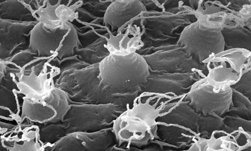 Picture 2 of The shape of the newly discovered water bear in Japan